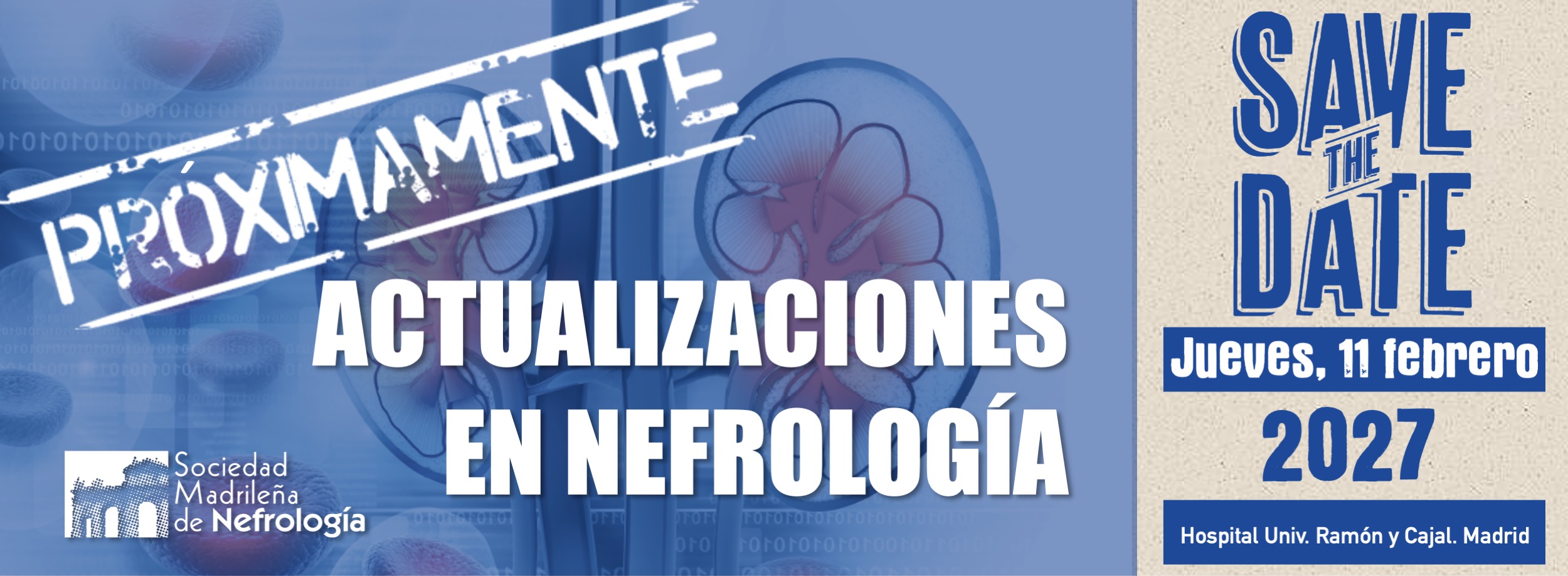 Actualizaciones 2027